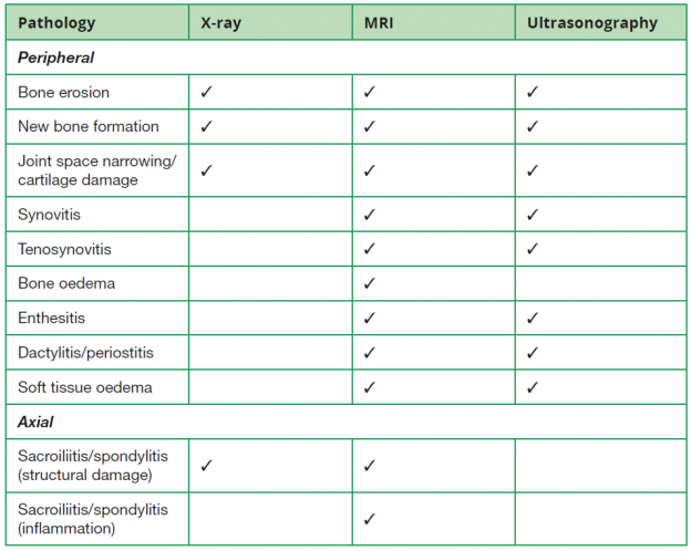 table 1 Screenshot - Key Opinions in Medicine